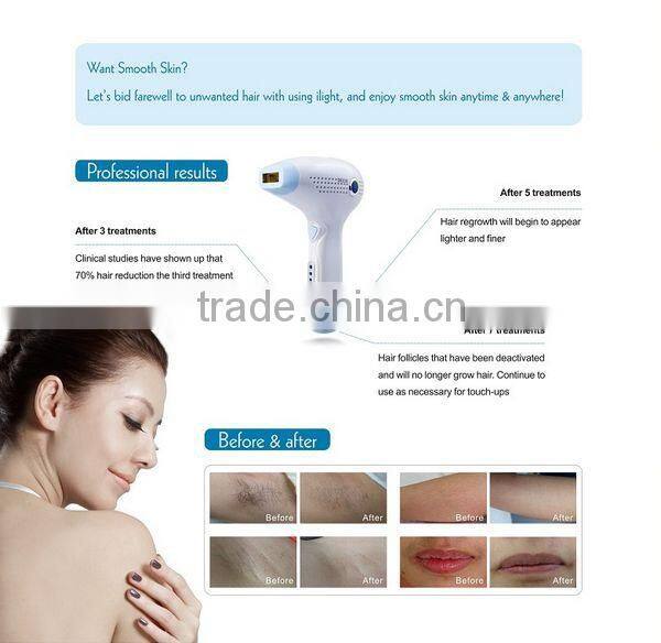 DEESS portable ipl laser hair removal machine home