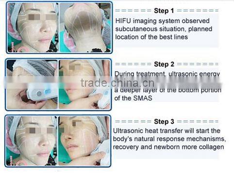 Professional HFU facial contouring best-sale High Intense Focus Ultrasound HFU10