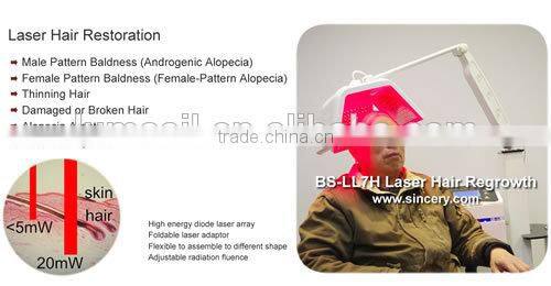 2014 New Arrival laser machine for hair loss