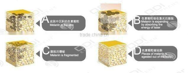 ND100 Laser Yag 200 Q Switch Nd Yag Laser Yag Tattoo Removal Machine with CE certificate