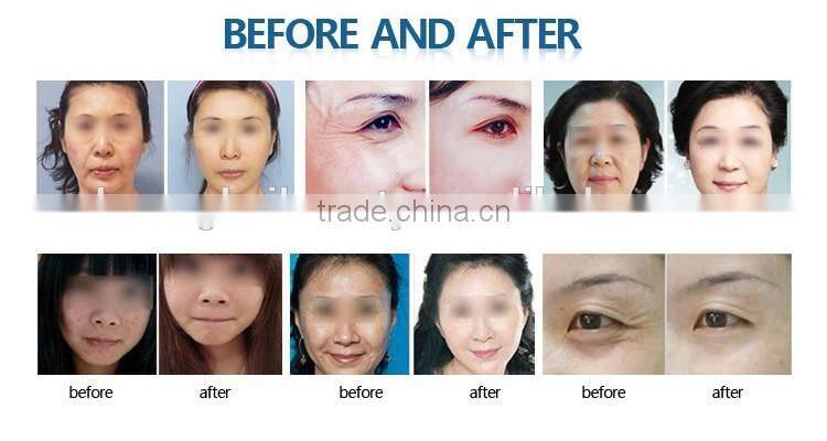 7 in 1 BIO diamond peeling dermabrasion oxygen therapy facial machine for sale