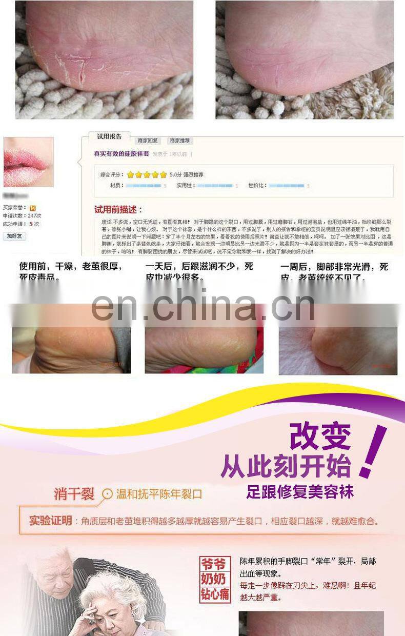 5-Toe Moisturizing Gel Socks#YG-06