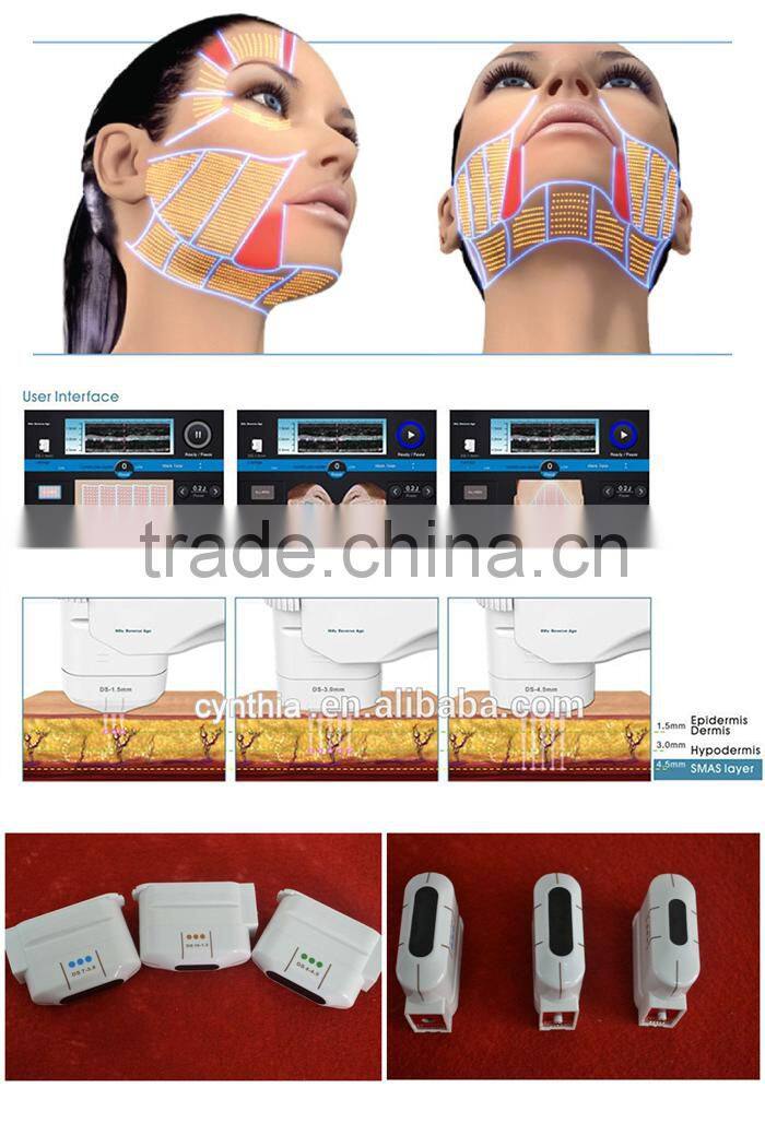 cavitation hifu High intensity focused ultrasound face lifting machine Cynthia RU1123B