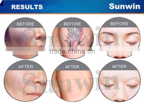 Sales Promotion!ND YAG Tattoo Laser beauty machine (SW-69E)