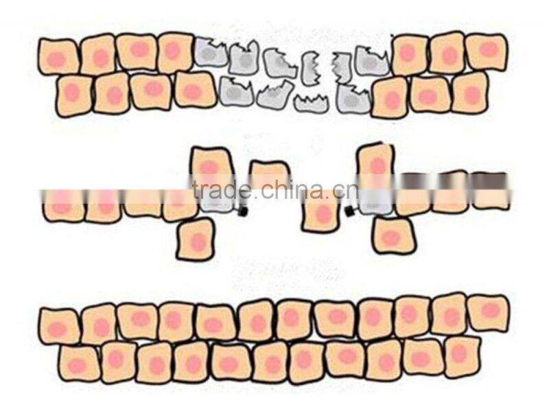 CO2 laser beauty device for vaginal tightening&vaginal nourish with high quality