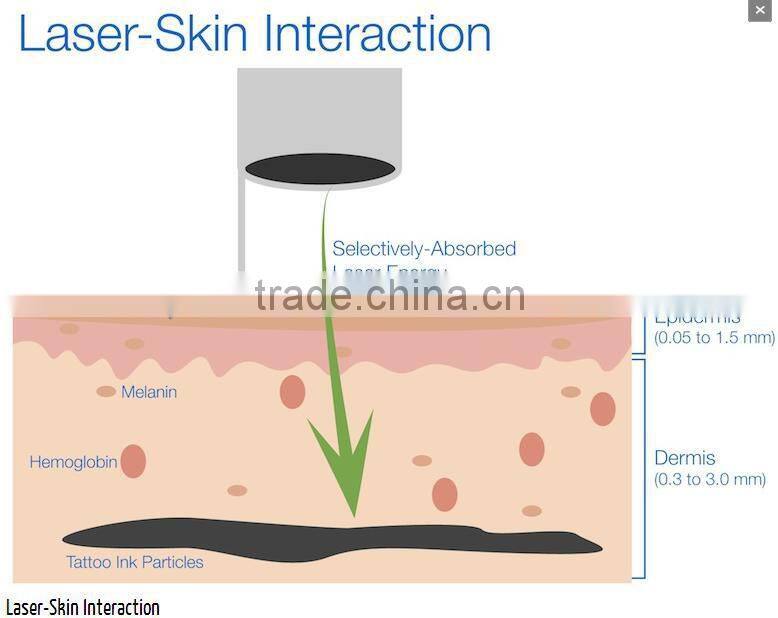 Raynol Factory Direct Sale!! Professional Technology Medical Q Switched Nd:YAG Laser Pigment Tattoo Removal Machine