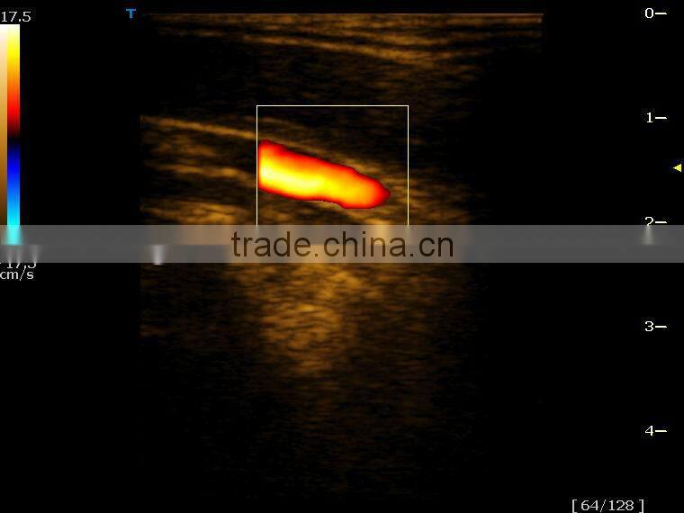 hot sale color doppler ultrasound for hot sale