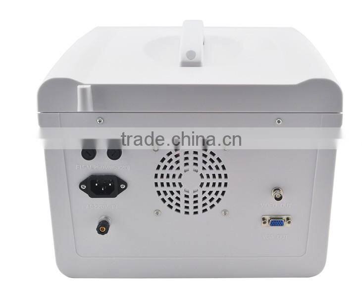 Cheapest Digital Portable Ultrasound Scanner RUS-6000D