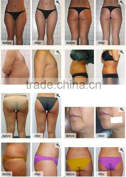 2012 Fat Kavitation Slimming Equipment-CE