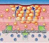 WL-41 Best home rf skin tightening face lifting machine