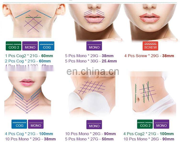Effective Multidimensional cog thread face lift equipment face products eyes forehead wrinkles mono 30mm pdo lifting filler