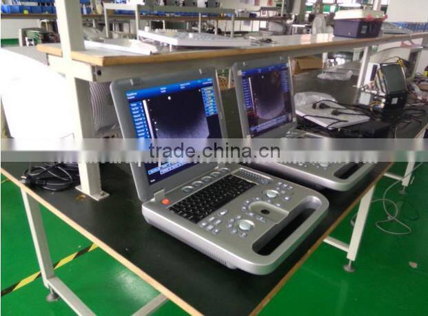 Portable Ultrasound Machine CU18A Made by Latest Color Ultrasoun Technology