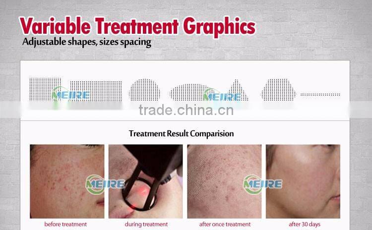 Factory price CE approved fractional co2 laser scar removal co2 fractional laser therapy
