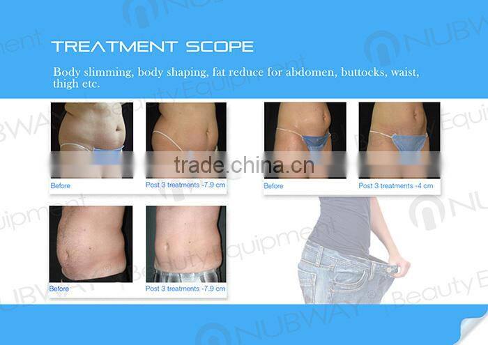 the most new designed slimming hifu high intensity focused ultrasound