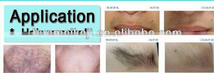 808 Diode Laser Hair Removal Machine beauty personal care