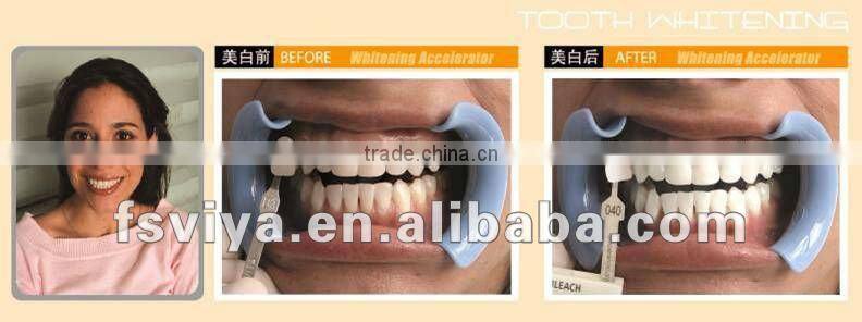 The best medical laser teeth whitening machine