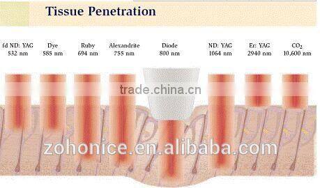 Y8B 808nm diode laser / diode laser hair removal / permanent hair removal