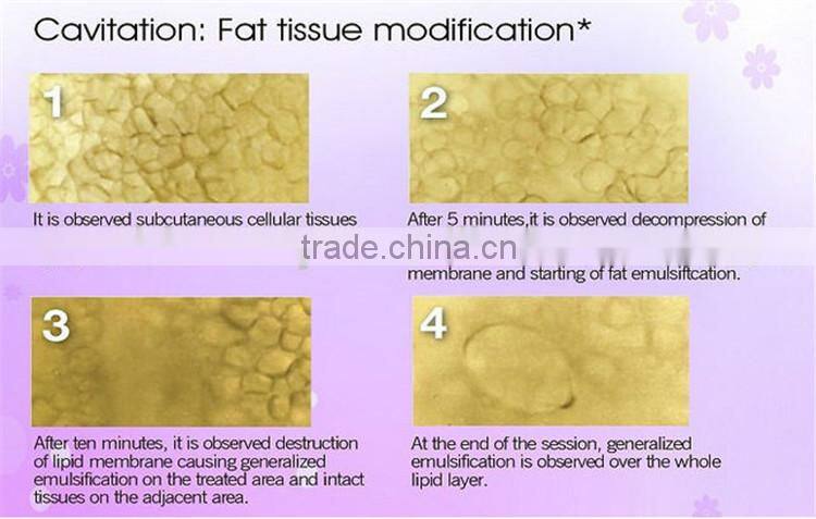 oem odm Safe and Effective Radio Frequency Ultrasonic Cavitation Freeze Fat Reducing Fat Apparatus For Sale