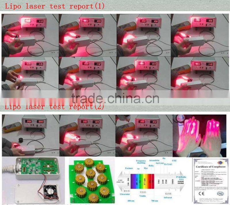 lipo laser/Winkonlaser lipo laser/double wavelengths lipo laser