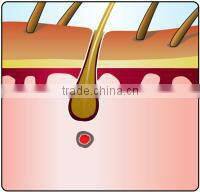 Best hair removal ipl photo epilation ipl and pigmentation home use