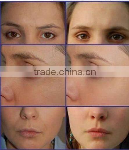 2015 Hot Sale !!! 7 colours pdt led phototherapy neonatal led phototherapy