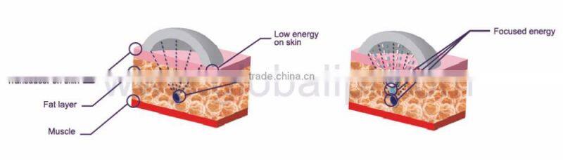 Vertical body slimming ultrashape cavitation beauty machine