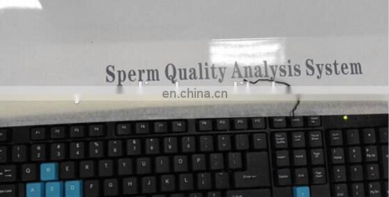 MY-B041A Medical Equipment Automatic Sperm Quality Analyzer /Semen Analyzer price/Sperm Analysis machine