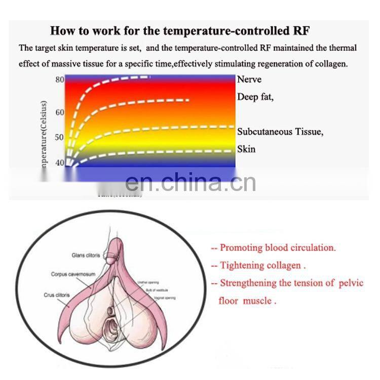 Portable female private parts nursing rf vaginal tightening rejuvenation beauty machine