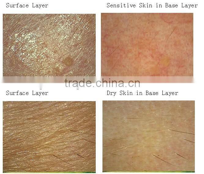 AYJ-J016 beauty salon equipment Portable Intelligent Digital Skin Analyzer 3d