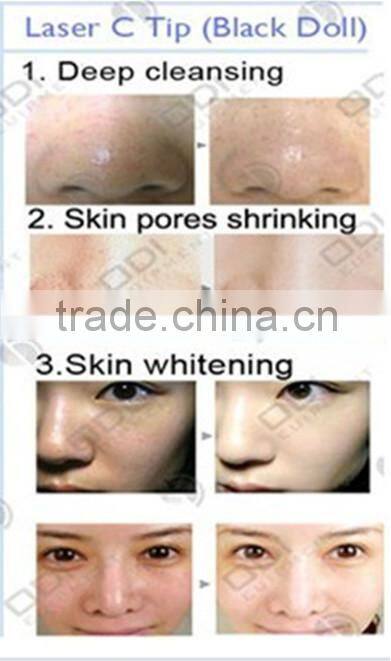 China Factory Best Black Doll skin rejuvenationcarbon powder 50g acne treatment laser carbon mask