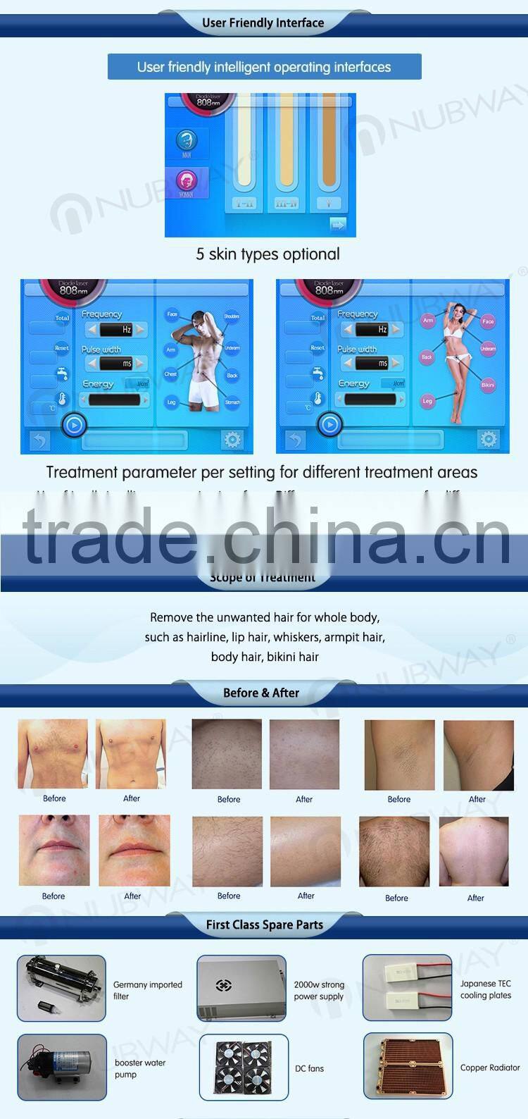 12*20 big spot size 10 layer laser bars permanent alexandrite 808nm diode laser hair removal machine price