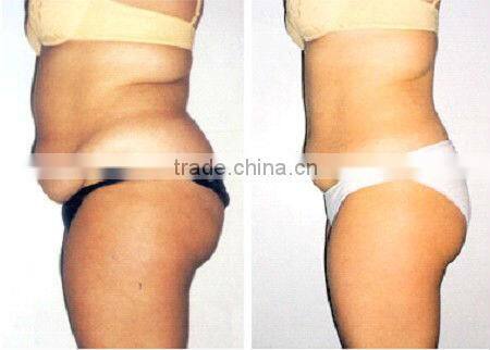 Special offer!! Medical cavitation slimming machine ultrasound equipment F013