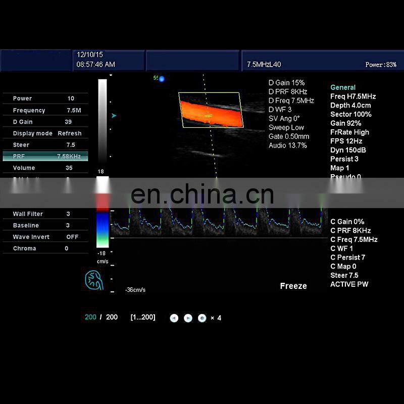 HC-A011 12 Inch High Resolution 128 elements Color Dopplor 3D 4D Ultrasound