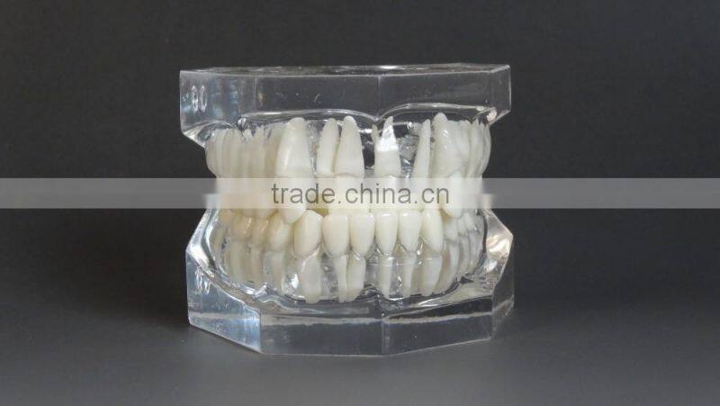 Malocclusion Classification Demonstration Model 1