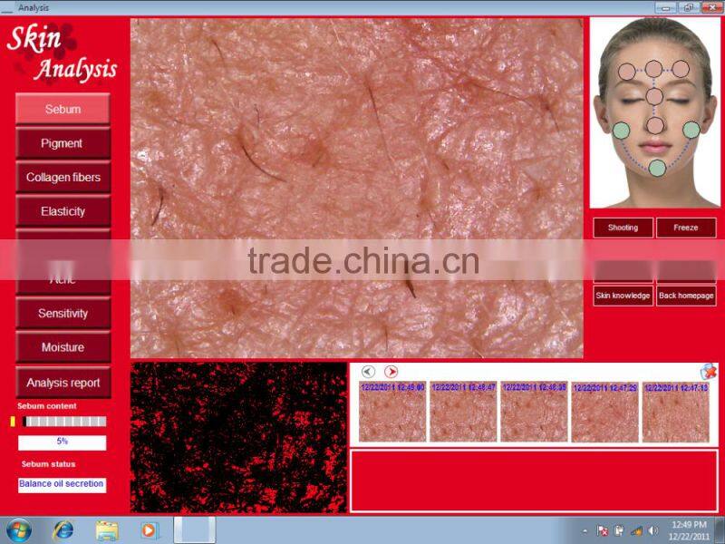 skin analyzer iris recognition machine