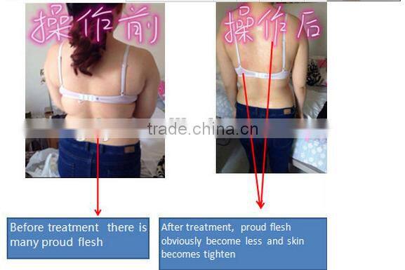 6 in 1 ultrasound + RF multifunctional cavitation weight lose machine