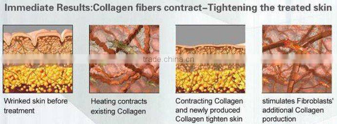 latest bipolar and tripolar radio frequency cavitation slimming beauty Fat Dissolving equipment