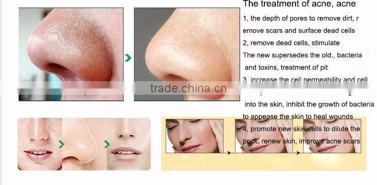 2017 Professional Portable Diamond Microdermabrasion Machine used beauty salon equipment Mini skin diamond peeling Machine