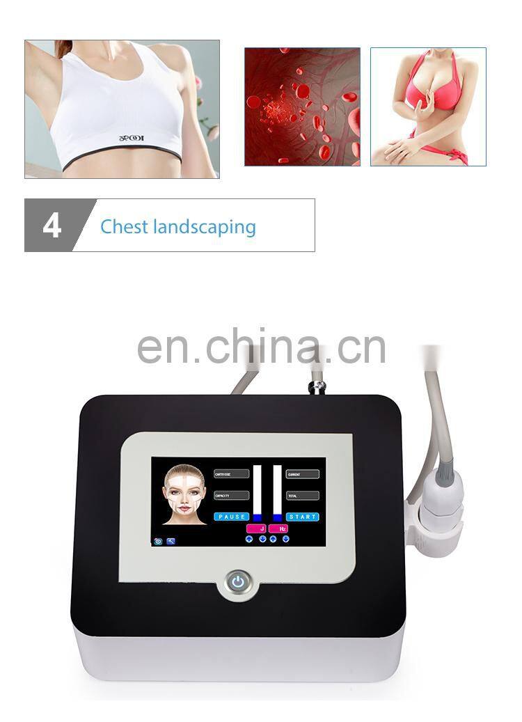 Portable radar line hifu focused ultrasound Wrinkle Remover