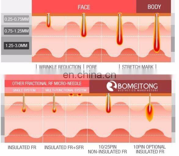 Newest fractional micro needle korea RF beauty machine
