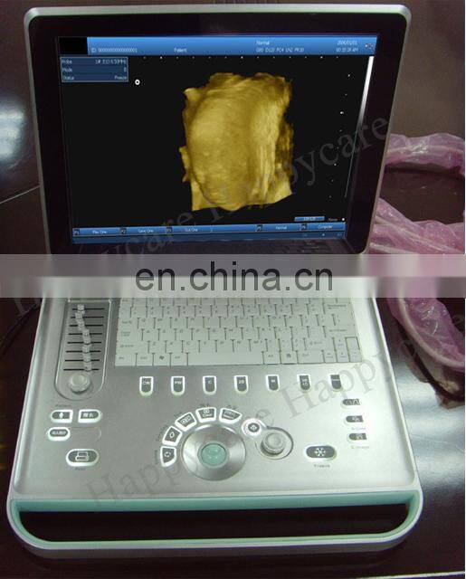 HC-A006A15 Inch Portable Black and White Ultrasound buy ultrasound scanner machines