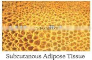 2012 Fat Kavitation Slimming Equipment-CE