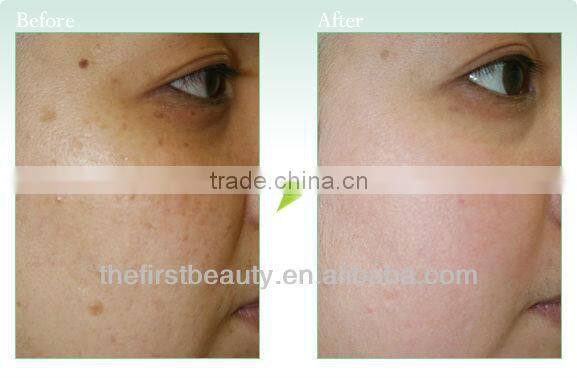 2016 best selling products micro needle pen 540 microneedle derma roller / facial and skin derma rollers skin care