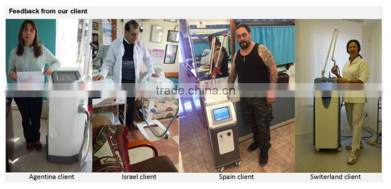 Hottest products 2017 portable home use nd yag laser remover tattoo