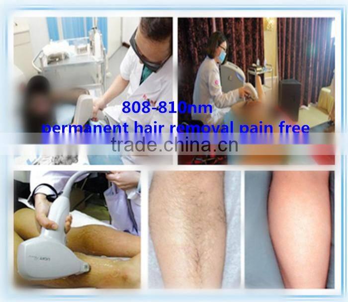 Professional Painless laser de diodo depilacion