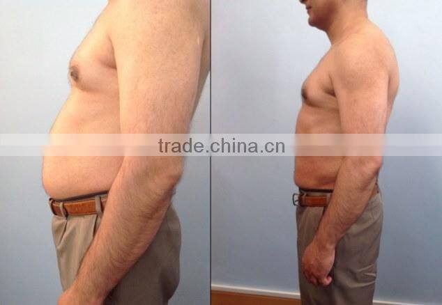 hifu fat reduce cavitation ultrasonic slimming machine