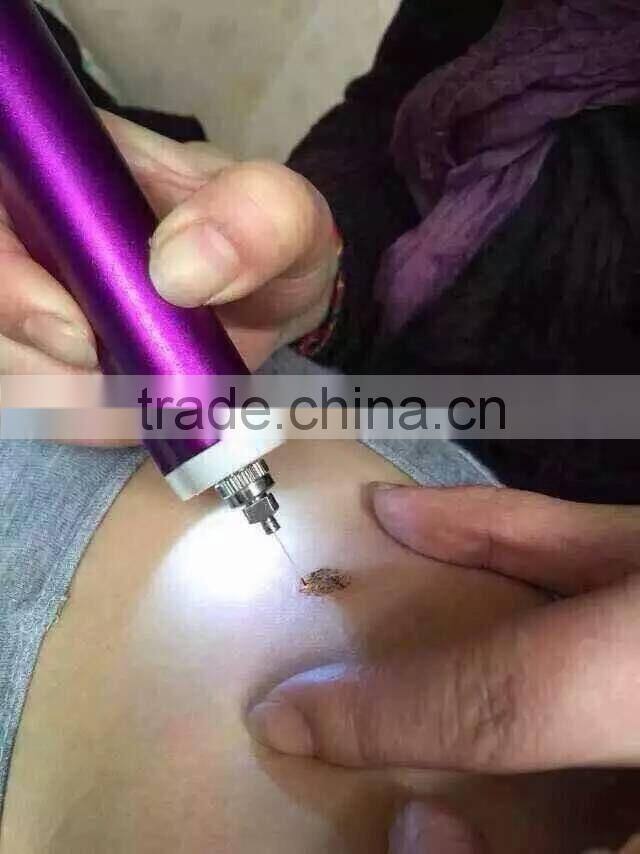 High Frequency Spot Removal Pen speckle removal