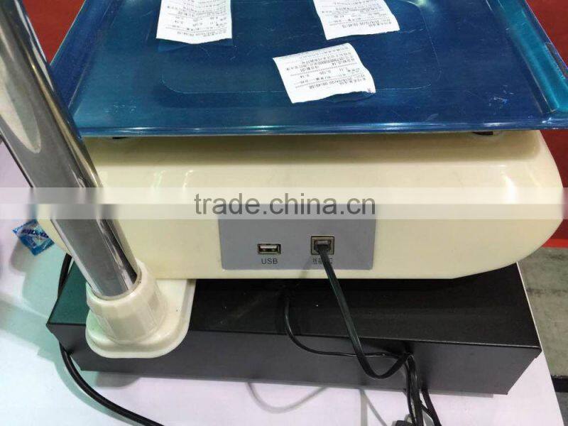 yonzo electronic digital food scale with printer
