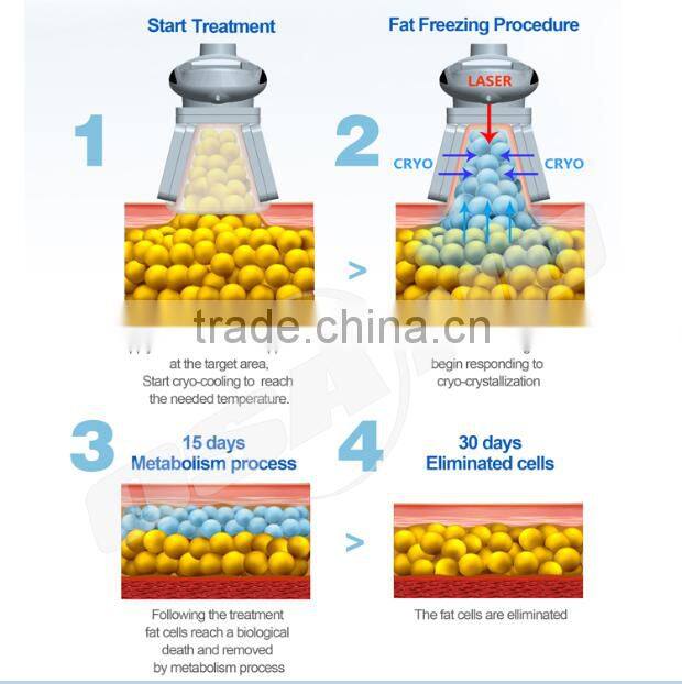 Salon Use Portable Single Cool Tech Vacuum Cryo Machine with CE