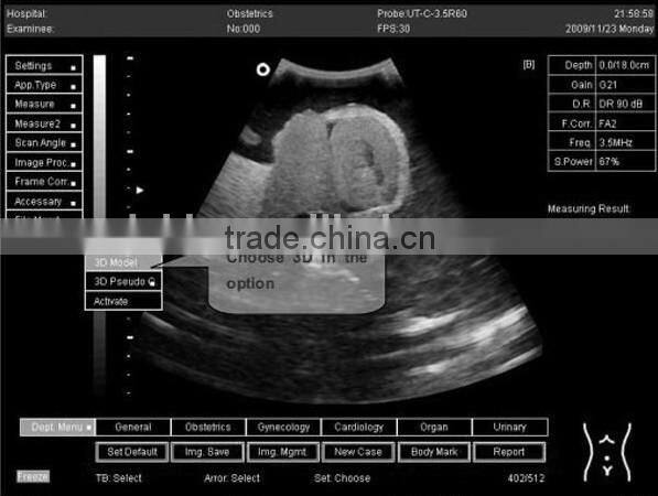 2015 new laptop ultrasound scanner (PC system) on Sale